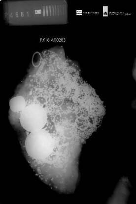 X-ray of concretion found on VOC-ship Rooswijk